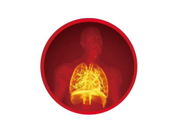 呼吸系统感染症候群病原微生物(wù)基因检测系列